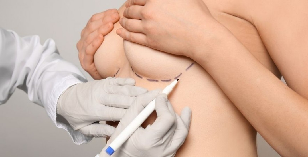 In What situations İs Reconstruction Necessary After Cosmetic Breast Surgery?