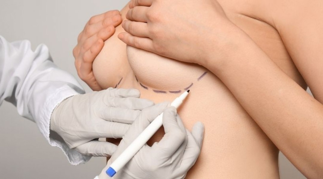 In What situations İs Reconstruction Necessary After Cosmetic Breast Surgery? In What situations İs Reconstruction Necessary After Cosmetic Breast Surgery?