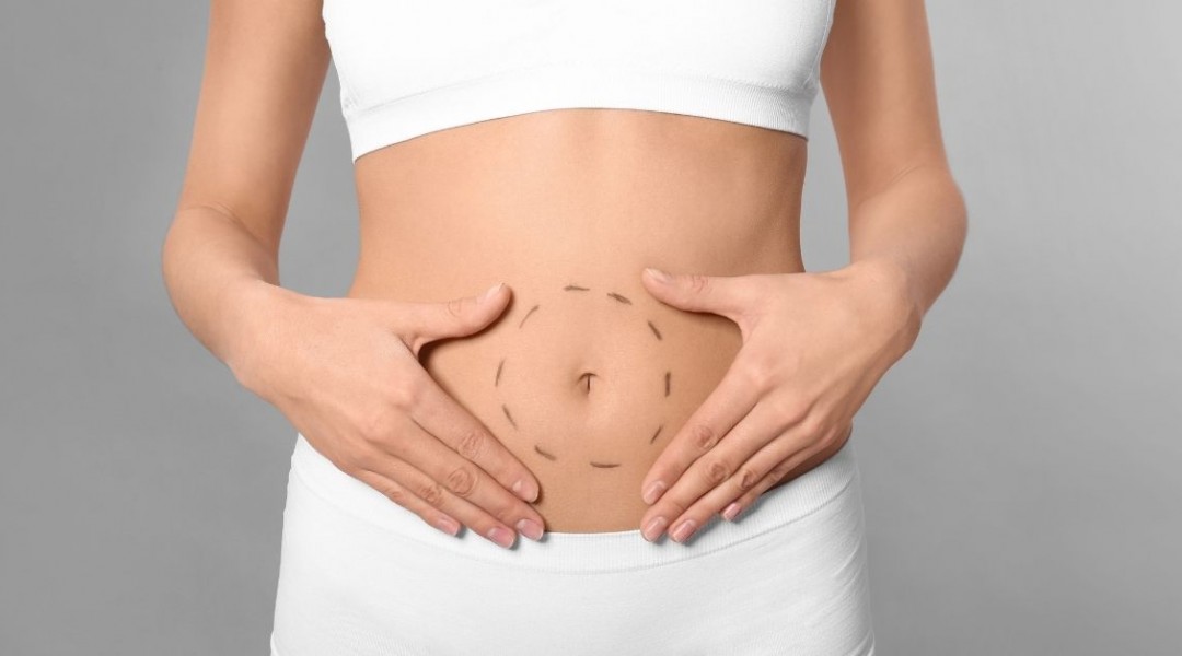 Tummy Tuck Surgery in Istanbul Tummy Tuck Surgery in Istanbul