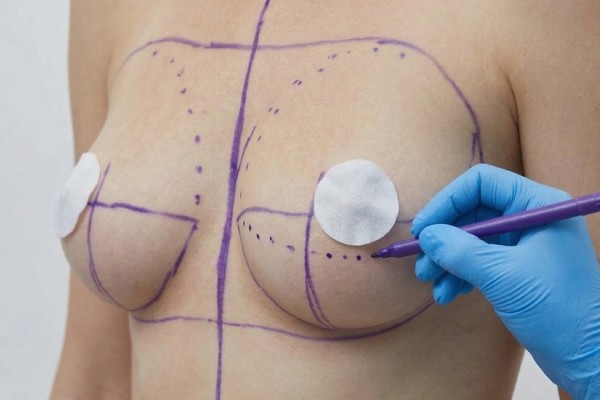 Meme Dikleştirme mi Meme Büyütme mi? Hangi Durumda Hangisi Tercih Edilir?