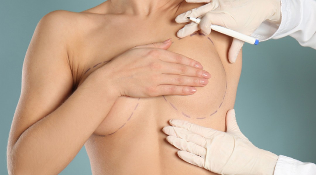 Breast Reduction Surgery