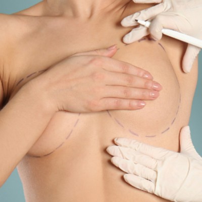 Meme Küçültme Estetiği