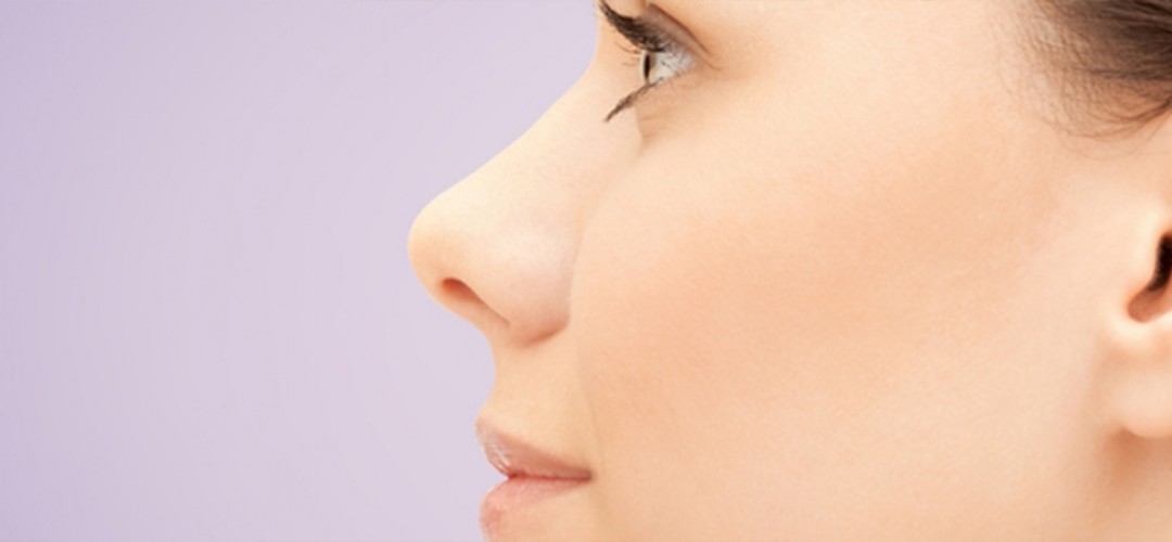 Rhinoplasty