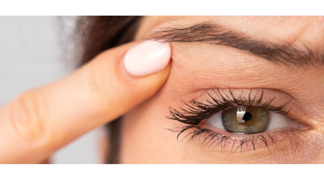 Eyelid Surgery