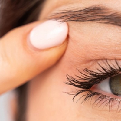 Göz Kapağı Estetiği