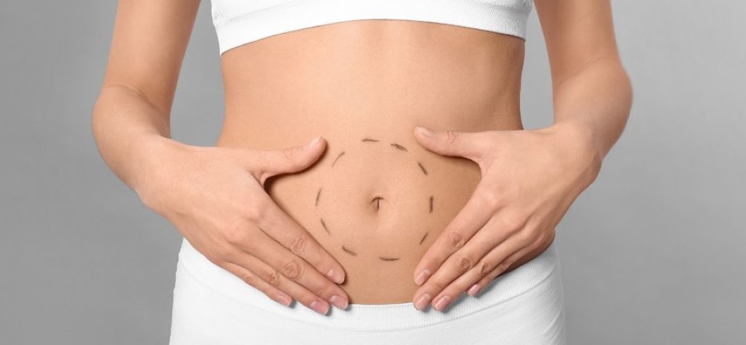 Tummy Tuck Surgery