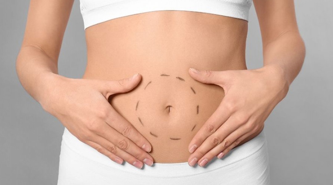Tummy Tuck Surgery
