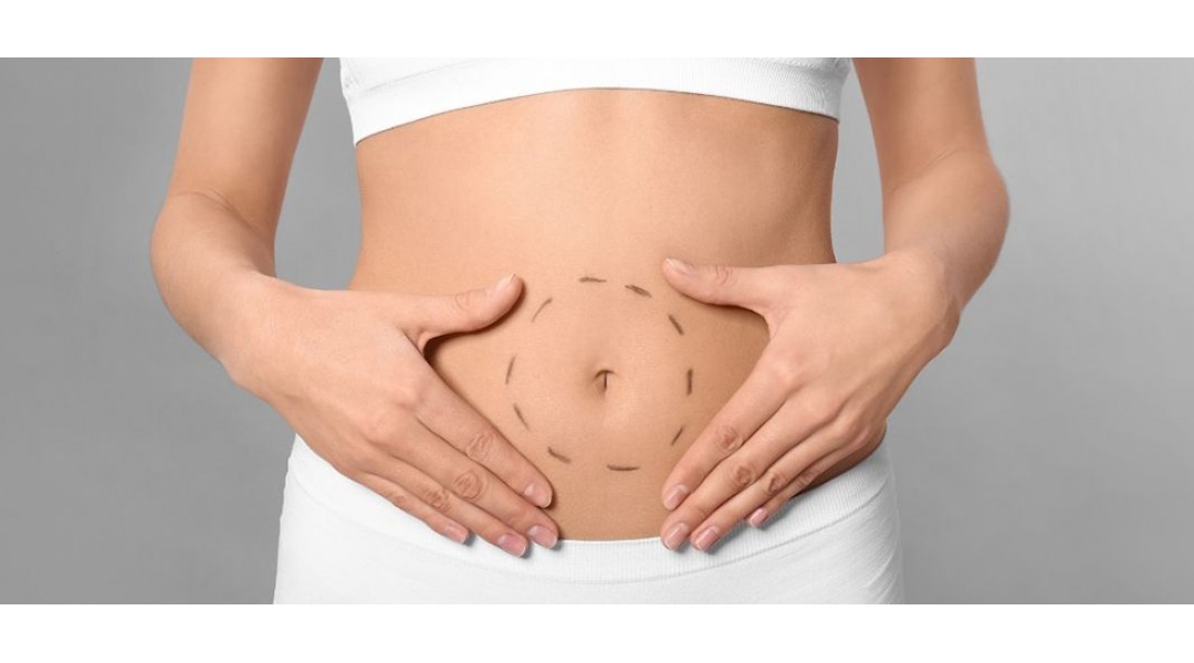 Tummy Tuck Surgery Tummy Tuck Surgery