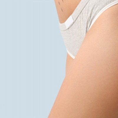 Kalça Şekillendirme Estetiği