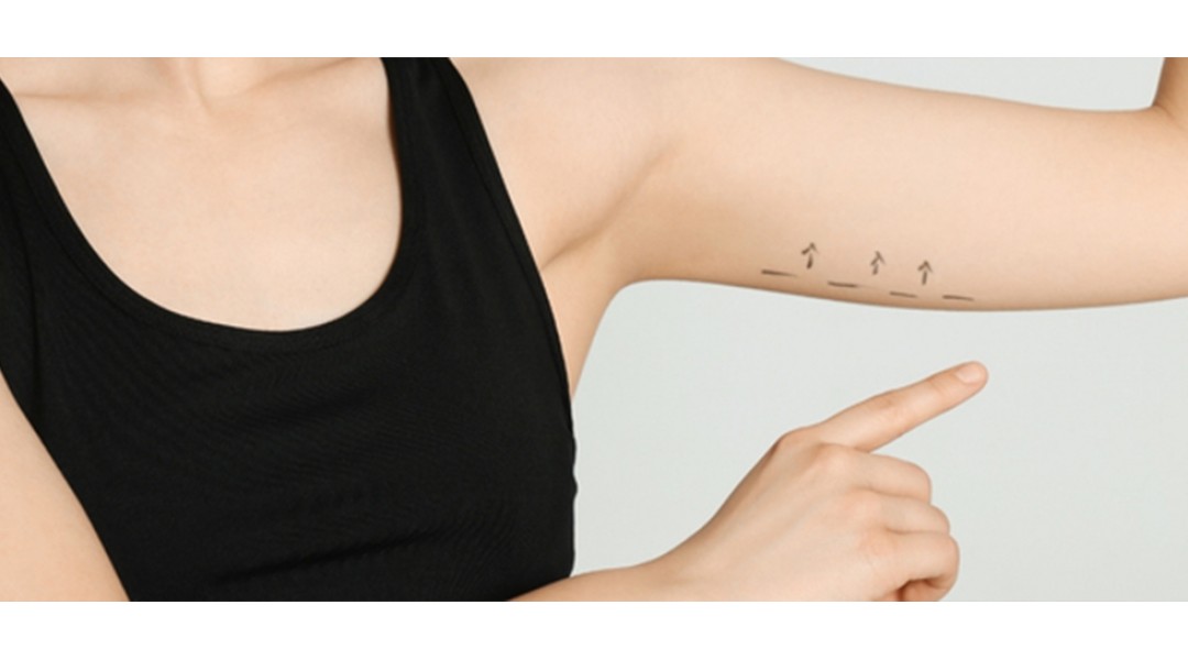 Arm Lift Surgery