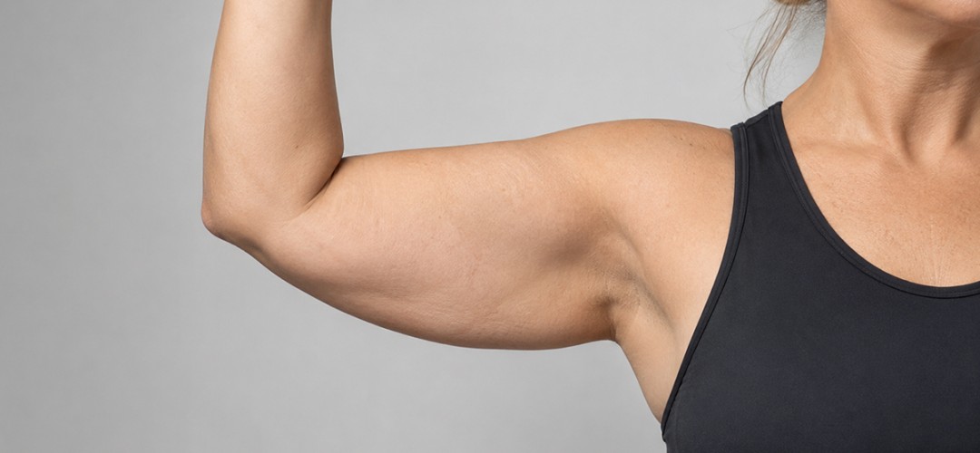 Arm Lift Surgery