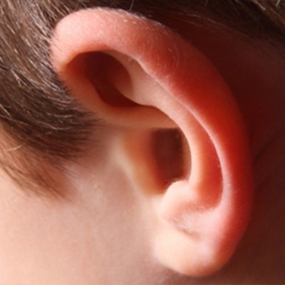 Kulak Estetiği (Otoplasti)