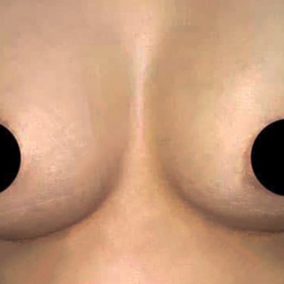 Meme Büyütme Estetiği