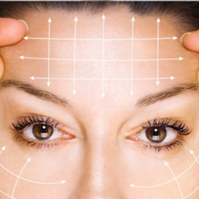 Temporal Lift (Şakak Germe) Nedir?