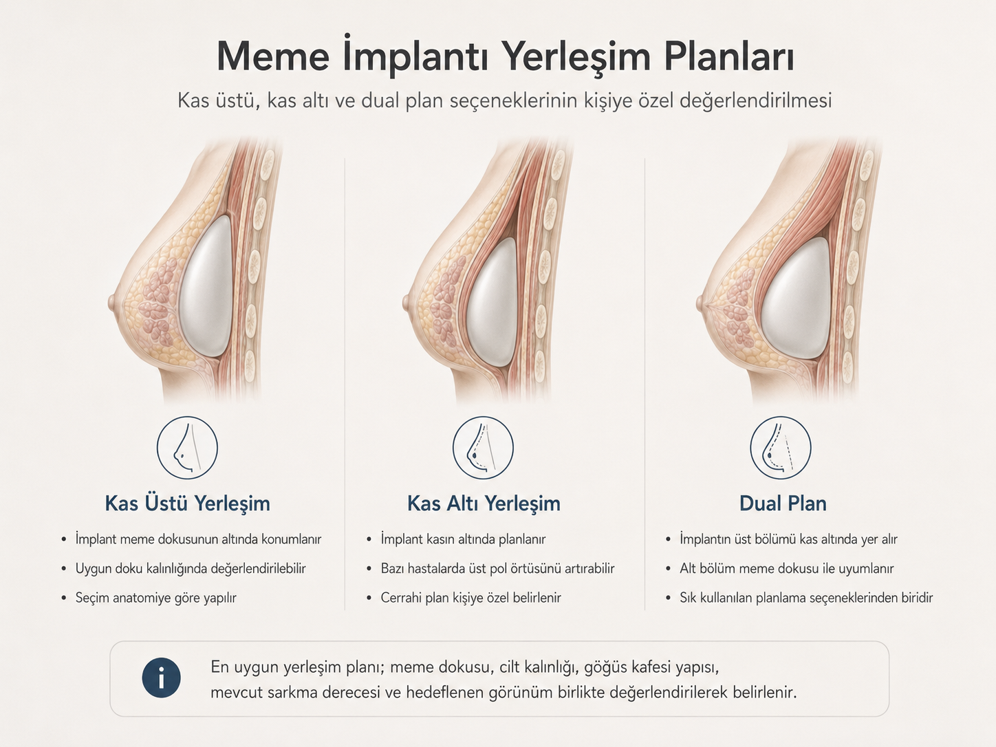 Meme implantının kas üstü, kas altı ve dual plan yerleşim seçenekleri